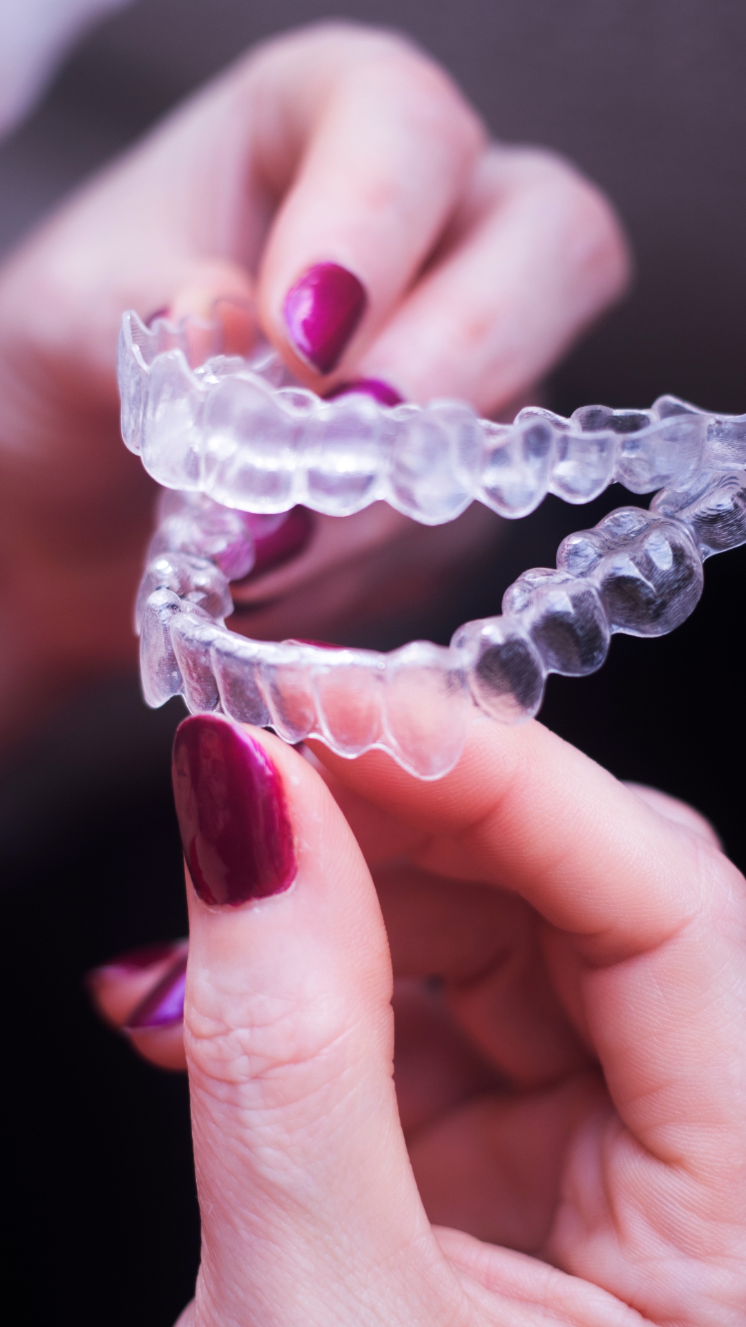 invisible orthodontics in Fuengirola