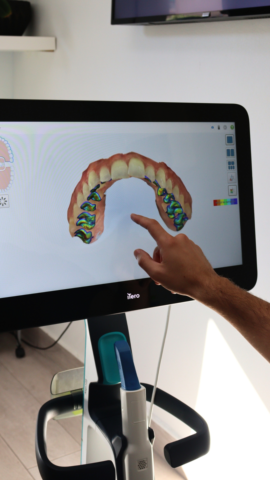 Invisible orthodontics in Fuengirola